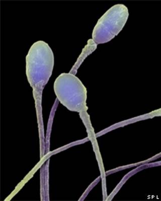 Espermatozoides