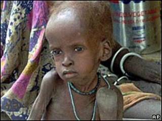 Niño desnutrido