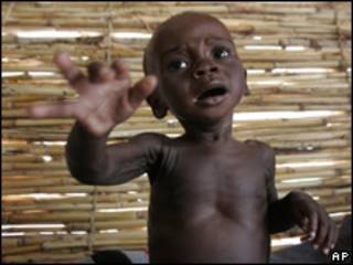 Niño desnutrido en Níger