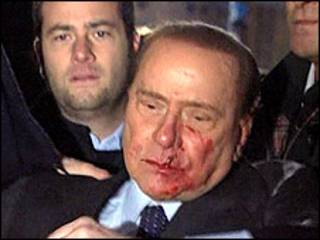 Silvio Berlusconi após ser atacado