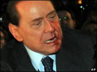 Berlusconi logo depois do ataque em dezembro de 2009 (arquivo)
