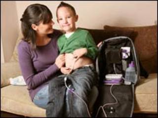 Keaton Foale com sua mãe e o tubo de alimentação (Caters News)
