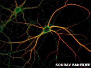 Neuronas