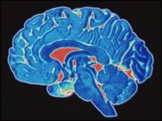 Sección del cerebro