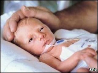 Bebê prematuro (arquivo)