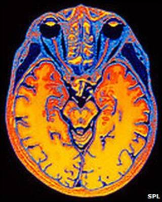 Cerebro