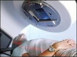 Radioterapia