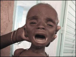 Wani yaro mai fama da tamowa a Nijer
