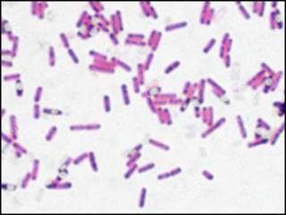 Bacteria