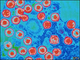 Virus del herpes