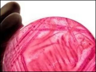 E.coli bacteria