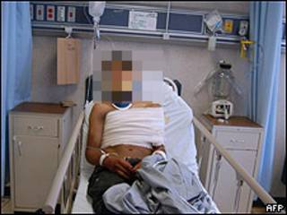 Freddy en el hospital donde fue hospitalizado tras sobrevivir a la masacre.