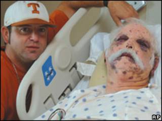 Homem atacado por abelhas no Texas (Foto: San Marcos Daily Record/AP)