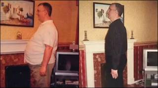 Tim Daily antes e depois da cirurgia