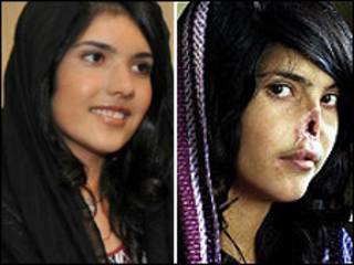 Imagen de Bibi Aisha en la revista Time y la actual