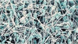 Sperm