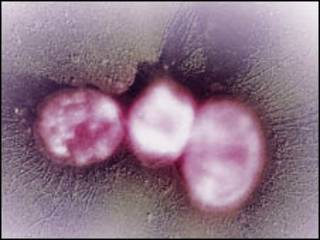 Klebsiella pneumoniae Carbapenemase (Foto: Fred Hossler/Visuals Unlimited/Scicence Photo Library)