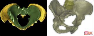 Pelvis de anciano hallada en las excavaciones de La Sima de los Huesos. Foto: Cortesía EIA