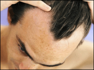 Hombre revisándose el cabello