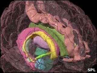Cerebro