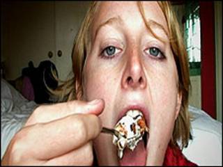 Obesidad