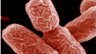 E-coli