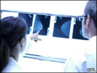 Médicos analisam uma radiografia de mama.