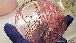 Bakteri E.coli