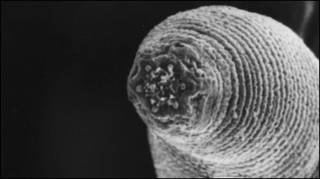 Boca do verme Halicephalobus mephisto (foto: cortesia Universidade de Ghent)