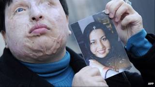 Ameneh Bahrami, víctima iraní de un ataque con ácido que reclama el mismo daño para su agresor.