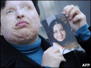 A iraniana Ameneh Bahrami. | Foto: AFP