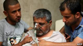 احد المتسممين بتسرب الكلور في بغداد