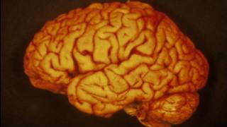 Cerebro