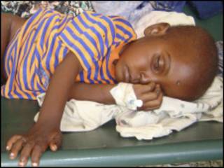 Daya daga cikin yaran da ke fama da tamowa a Somalia