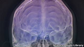Cerebro humano