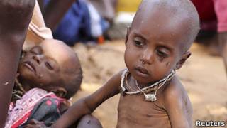 Hambruna en Somalia