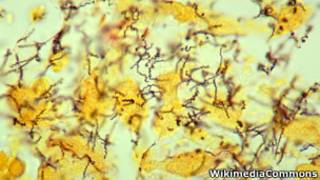 Bacteria da sífilis. WikimediaCommons