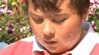 Patrick Flinders foi vítima de ataque de um urso polar (BBC)