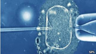 Inseminação artificial