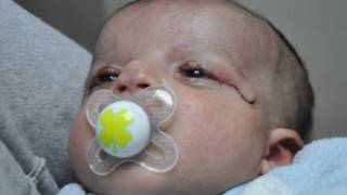 Photo: Courtesy of Kaplan Hospital