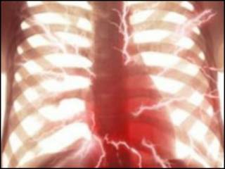 英國心髒病致死率急劇下降