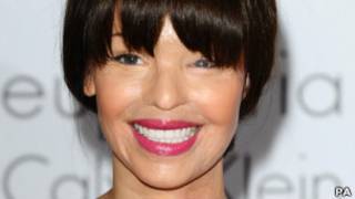 Katie Piper (PA)