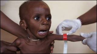 Wani yaro mai dauke da Tamowa a Nijar