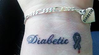 Tatuaje médico (Foto cortesía de Diabetes Advocacy).