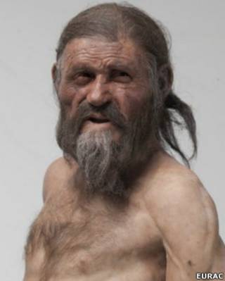 oetzi