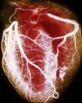 corazon
