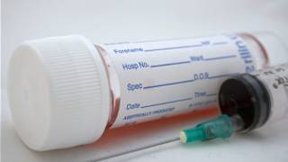 Exame de sangue (BBC)