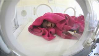 طفل حديث الولادة في حاضنة