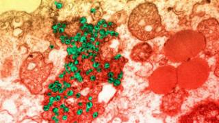 فيروس HIV