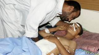 صبي جريح بانفجار في بغداد 23/06/2012